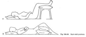 Spine sparing technique in Spotsylvania and Fredericksburg, the semi-traction position.