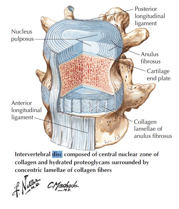 Disc as illustrated by Dr. Netter. Showing the nucleus and all the annular fibers.