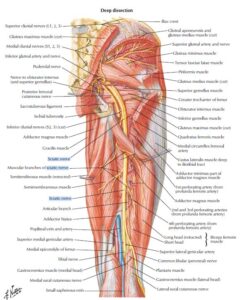 Picture illustrating the position of the sciatic nerve in relation to the piriformis muscle. Sciatica pain.