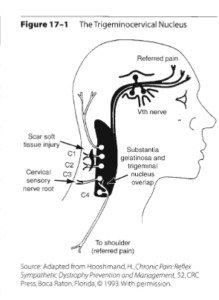 Fredericksburg chiropractor. Spotsylvania chiropractor. Migraine relief Fredericksburg. Migraine with aura. Migraine without aura. Migraine treatment