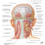 Stine Chiropractic Clinic. Illustration of the suboccipital muscles by Netter. Tension headache treatment. Fredericksburg chiropractor. Chiropractor Fredericksburg Va. Spotsylvania chiropractor. Chiropractic orthopedics. 