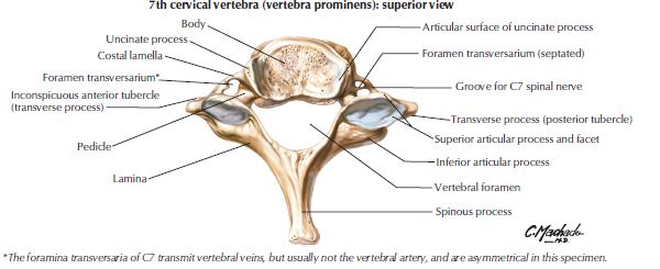 Spinal stenosis, Fredericksburg chiropractor, pinched nerve