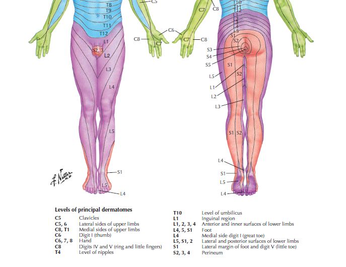 Lower body dermatomal map from injured nerve roots.