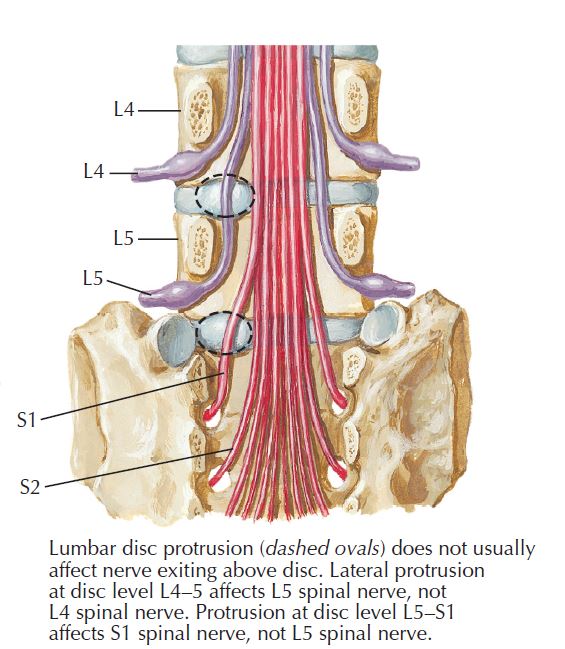 Picture of exiting nerve roots as they pertain to their spinal levels. Some of these nerve roots combine to form the bundled peripheral nerve called the sciatic nerve.
